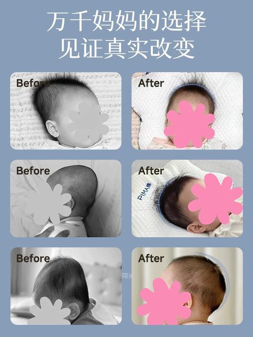 Pima棉定型枕头婴儿0到6个月以上新生儿头型儿童宝宝枕头防偏头 商品图1