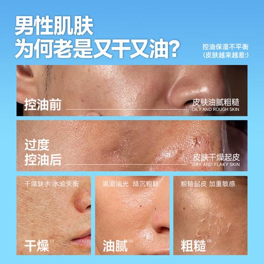 左颜右色 微酸净肤套装（3件套） 商品图3