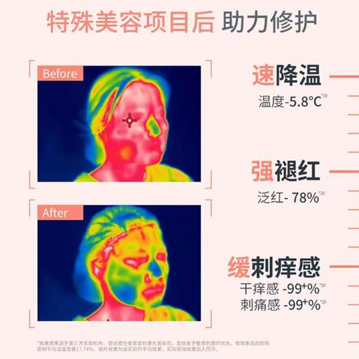 雅漾舒泉调理喷雾300ml*4+雅漾专研保湿修护面膜2盒 商品图2